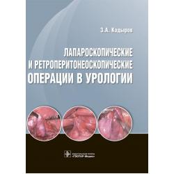Лапароскопические и ретроперитонеоскопические операции в урологии