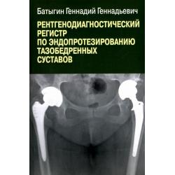 Рентгенологический регистр по эндопротезированию тазобедренных суставов