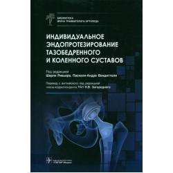 Индивидуальное эндопротезирование тазобедренного и коленного суставов