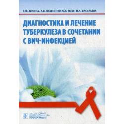 Диагностика и лечение туберкулеза в сочетании с ВИЧ-инфекцией